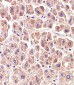 ALDH6A1 Antibody